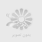 ایمپلنت دندان دائمی است؟ همه چیز درباره طول عمر و ماندگاری آن